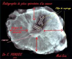 radiographie-piece-operatoire-1.jpg